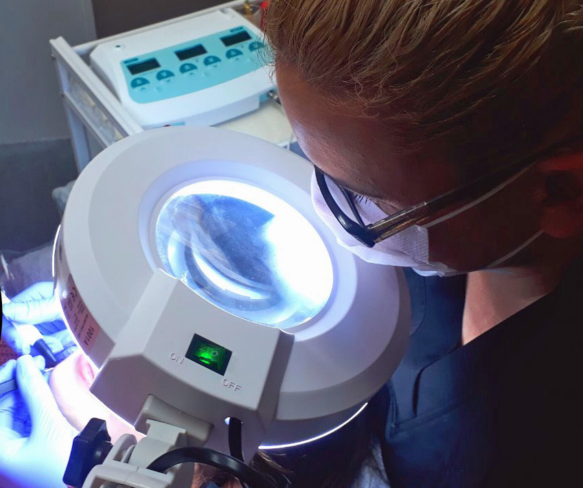 Electrolysis Hair Removal Richmond Red Vein & Skin Tag Removal